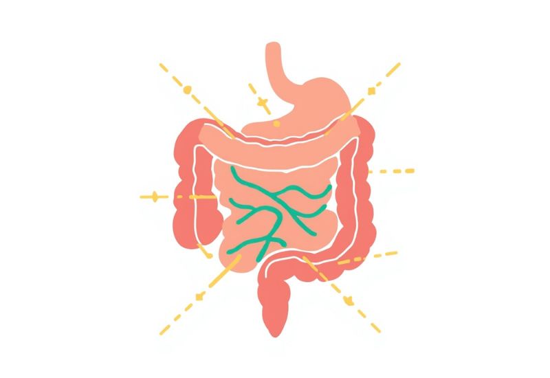 توضيح أن القولون العصبي اضطراب وظيفي مع سلامة شكل القولون