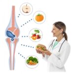 هل النقرس سببه الطعام فقط؟