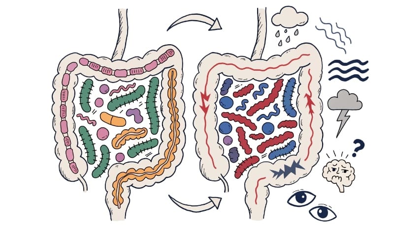 تأثير القلق على البكتيريا النافعة