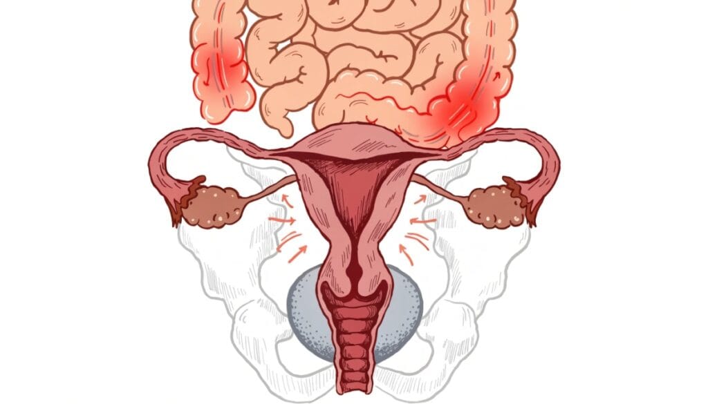 ألم أسفل البطن عند النساء وتوضيح الأعضاء الداخلية في الحوض