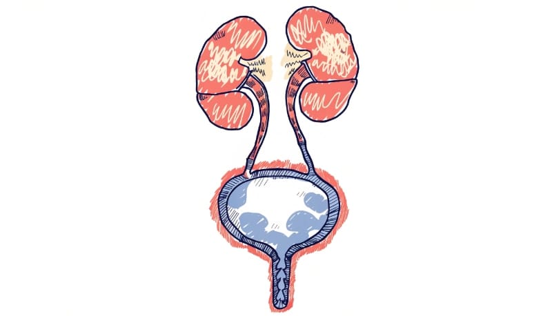 رسم طبي يوضح التهاب المسالك البولية لدى النساء