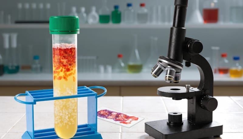 تحليل البول